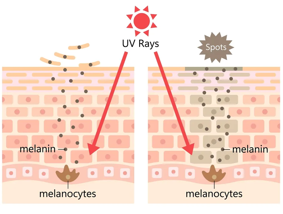 What is Melanin?