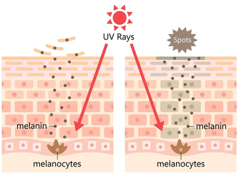 What is Melanin? – Levels 2 Skin