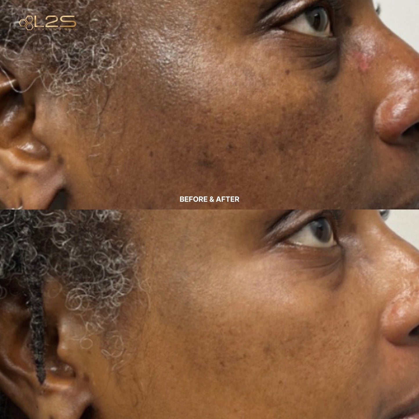 2 Step Anti-Aging Defense System