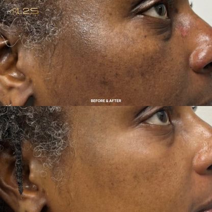 2 Step Anti-Aging Defense System