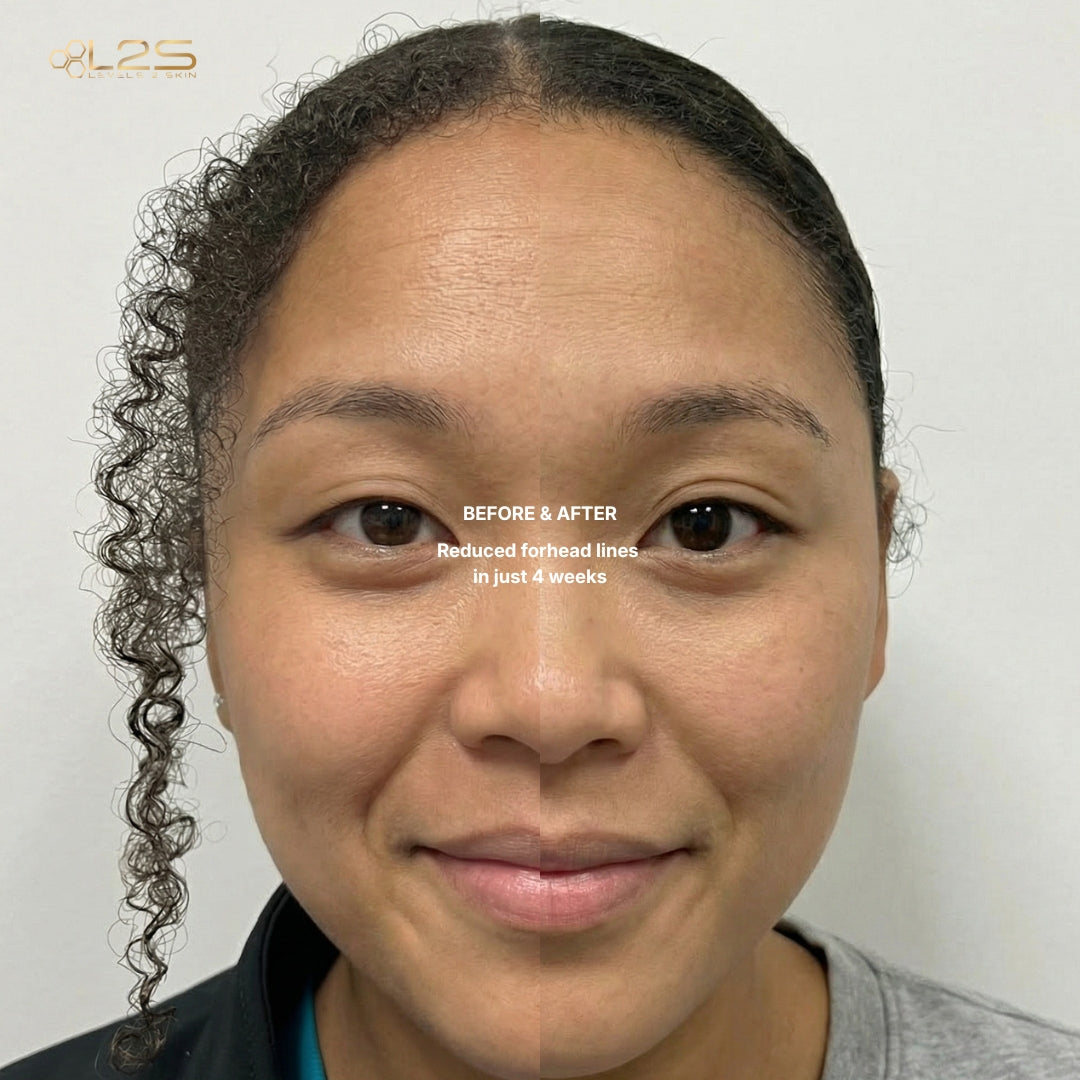 2 Step Anti-Aging Defense System